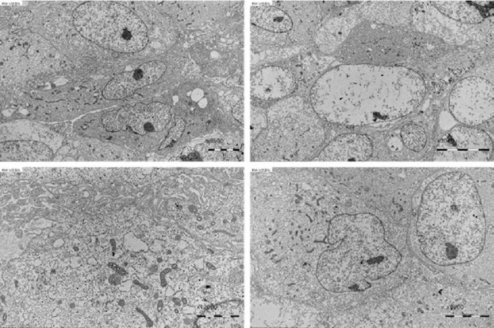 Transmission electron microscopy (TEM) 촬영올 통한 RPE외 미세구조 확인