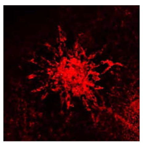 laser를 이용한 choroidal neovascularization (CNV)의 생성