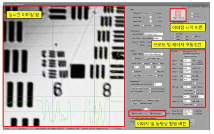 피부 진단용 UI 개발