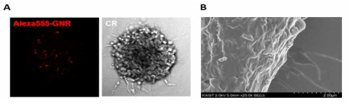(A) 공초점 현미경으로 세포 주변에 존재하는 형광 세기를 확인한 형광물질 (Alexa555) (왼쪽)과 뇌종양 구 (오른쪽) (B) 주사전자 현미경으로 관찰한 세포막에 존재하는 금나노입자