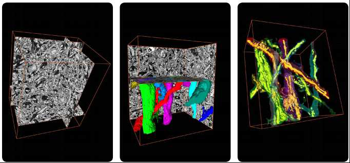 SBFSEM을 이용한 3차원 전자현미경 이미지