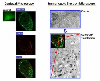 광학-전자현미경 연계 분석법을 이용한 세포소기관 구조분석 예시