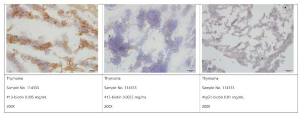 양성컨트롤 암조직(Thymoma)에 대한 염색 패턴 조건 실험