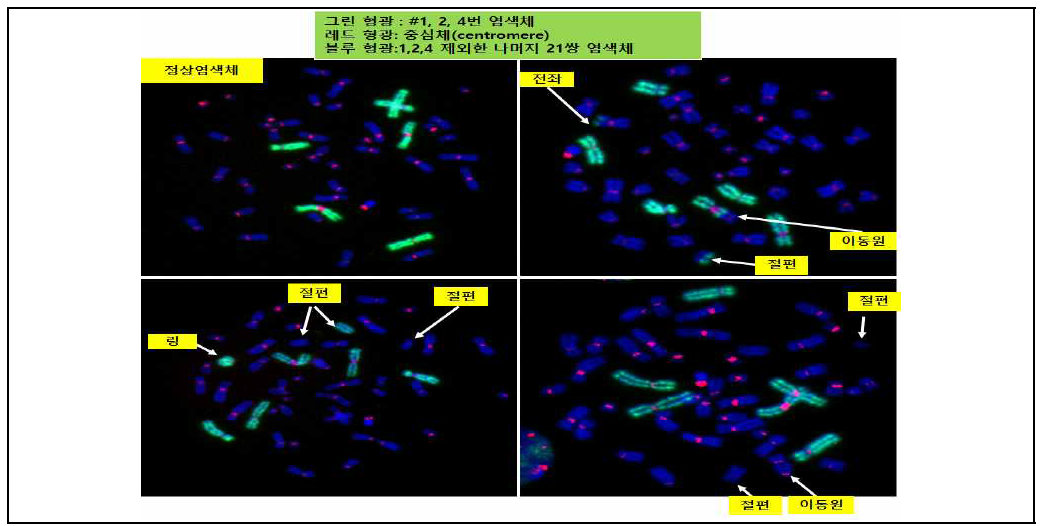 형광이미지로부터 전좌와 이동원 염색체 검출