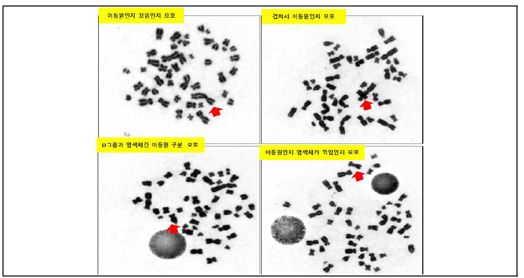 김자염색법을 이용한 이동원염색체 구분이 모호한 경우 판독 사례