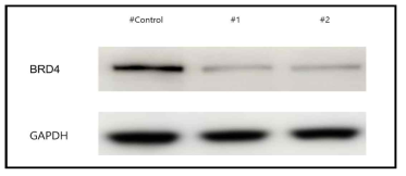 HepG2 cell line에 shRNA를 이용하여 BRD4 유전자 knockout cell line 구축