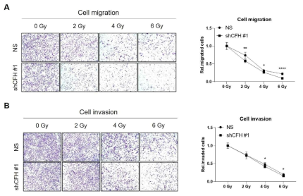 CFH 발현 억제된 MDA-MB-231 세포에서 방사선 조사에 의한 이동성 및 침윤성 감소 수준 검증