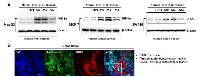 정상산소조건에서 대식세포 유형에 따른 HIF-1α 발현 변화