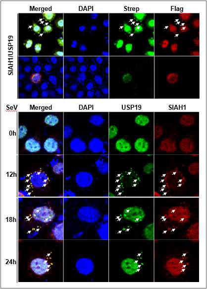 SIAH1과 USP19의 상호작용 확인 (confocal assay)