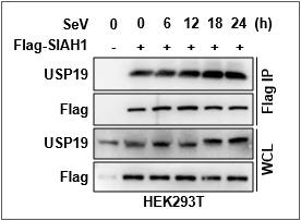 SIAH1과 USP19의 상호작용 확인 (Endogenous interaction)