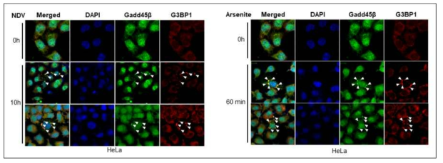 Gadd45β와 G3BP1과의 상호작용 확인 (confocal assay)