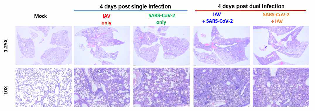 Influenza virus (IAV)와 SARS-CoV-2 virus coinfection 후 폐 조직 결과