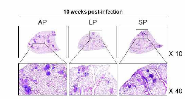 식이에 따른 폐 조직 Hematoxylin-Eosin (H&E) staining 비교