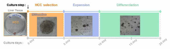 간암 튜머로이드 선별 및 배양 과정