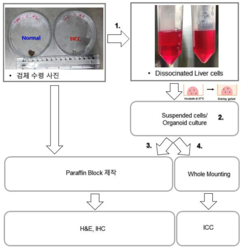 환자 유래 간암 검체에서 일차배양 방법 및 분석 모식도
