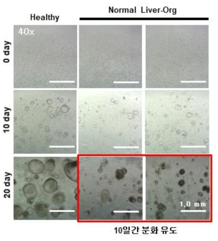 정상 간 오가노이드의 형성 관찰