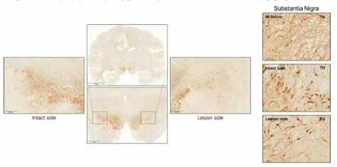 PD 모델 제작 1차 예비 실험 (Hemi-parkinsonian model) – 조직학적 증상 평가 (IHC) #2