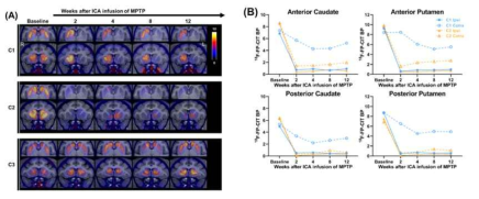 PD 모델 제작 2차 예비 실험 (Hemi-parkinsonian model) – 핵의학적 평가