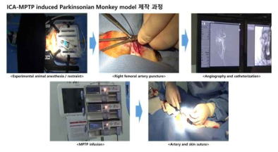 ICA_MPTP 투여 Hemi-parkinsonian 영장류 모델