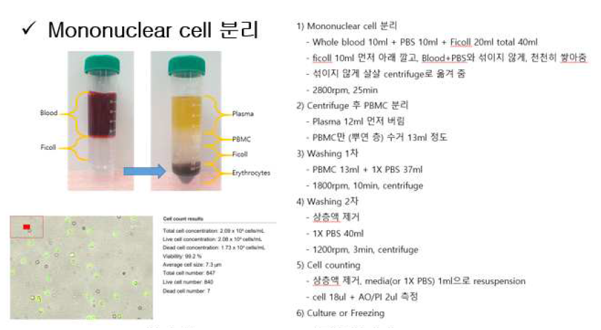 Mononuclear cell 분리 후 cell counting 사진 및 분리 protocol SOP