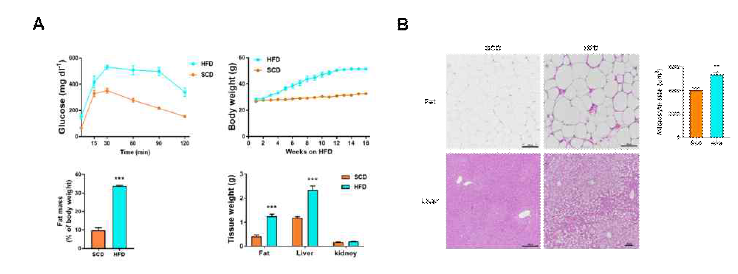 대사환경에 따른 미토 콘드리아 단백체 특이성 분석 을 위한 동물모델 구축 (A) Obese/diabetic mouse model (B) NAFLD mouse model