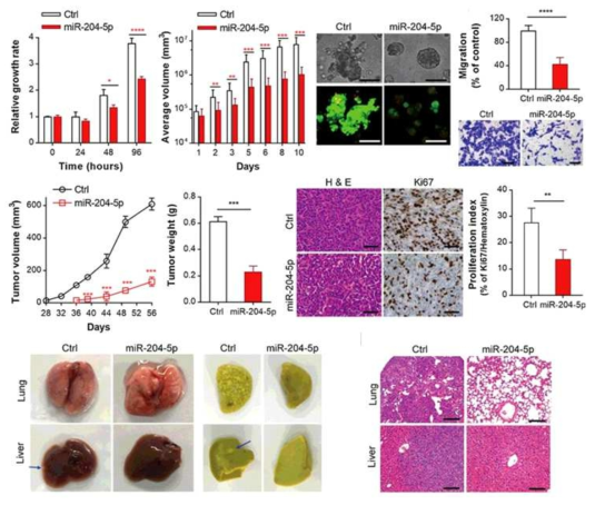 유방암 Tumor suppressor miR-204-5p에 의한 유방암의 성장과 전이조절