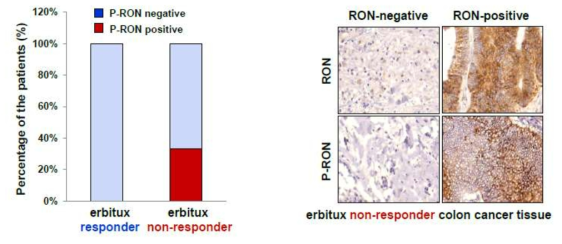 Erbitux 저항성을 보이는 환자 샘플에서 p-RON 발현 확인