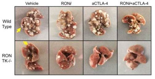 RON kinase 저해제와 anti-CTLA4 병용요법으로 인한 종양 억제 효능 확인 (Oncoimmunology, 2018, 7, 9, e1480286)