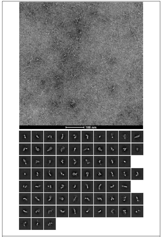 투과전자현미경 (transmission electron microscope, TEM) negative staining (위)과 2D averaging (아래)을 활용해서 PCNAdm-3HA를 관찰한 결과