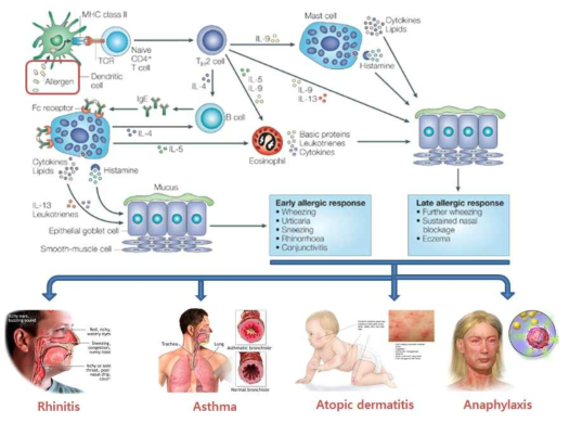 알레르기 질환의 pathogenesis