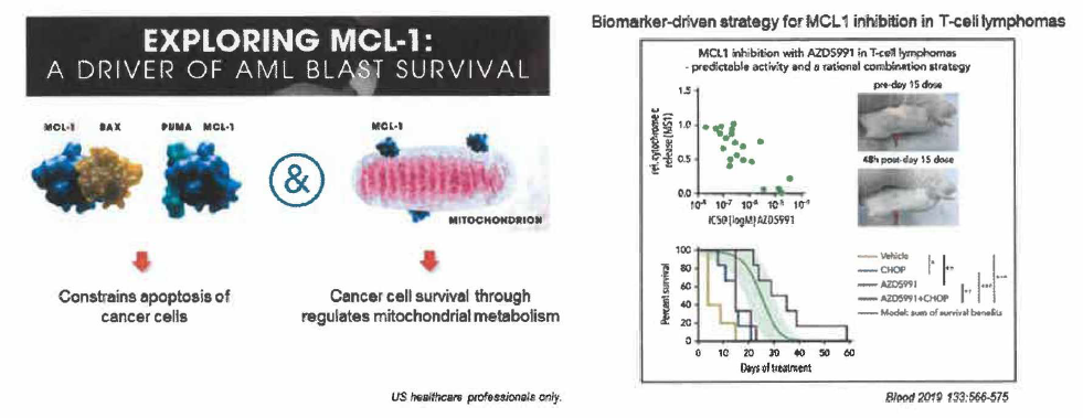 Biomarker-driven strategy for MCL-1 inhibition in hematological cancer