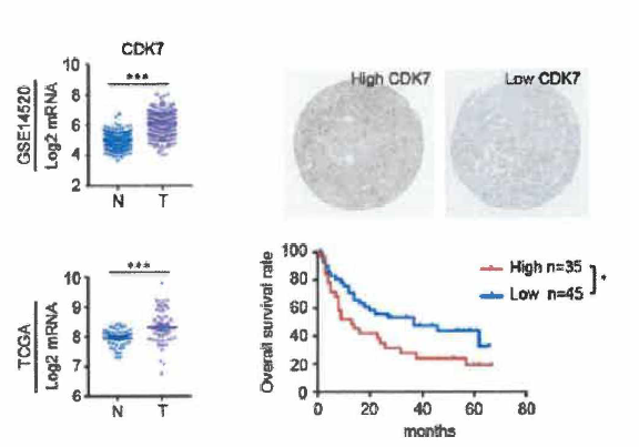 (A) CDK7 expression in non-tunor(N) and HCC cohort(T), (B) Association of CDK7 expression with prognosis in HCC patients (Cell Research 2018, 0:1 -3)