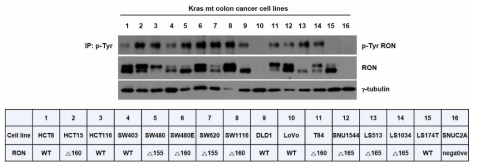 KRAS mutant 대장암 세포주에서의 RON 발현 확인 결과