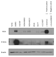 유방암 세포주에서의 RON 발현 확인 결과