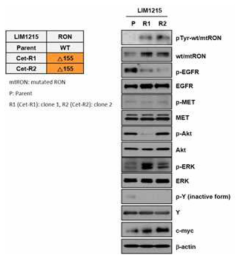 Cetuximab 2차 저항성 세포주에서 RON pathway 단백질들의 발현 변화 확인