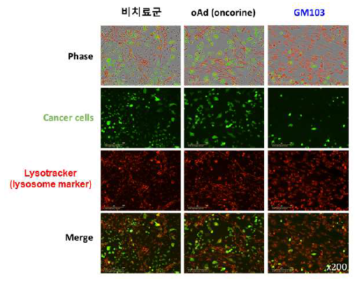 경쟁 항암바이러스(Oncorine) 대비 GM103의 선택능 및 살상능 검증