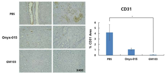 GM103의 치료유전자 shVEGF에 의한 anti-angiogenesis 효과 (in vivo: H1975)