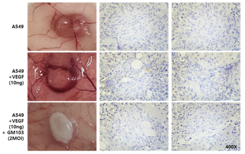 GM103의 치료유전자 shVEGF에 의한 anti-angiogenesis 효과(matrigel plug assay)