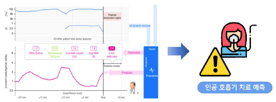 환자 인공호흡기 치료 필요성 분석