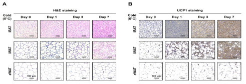 추위 자극에 의한 지방세포 브라우닝 분석 조건 확립