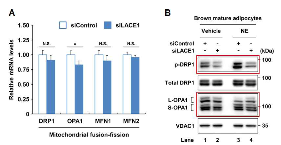 LACE1의 억제발현 시에 갈색지방세포 내 미토콘드리아 fsion-fission 기능이상