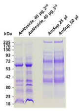 준비된 상등액과 vesicle에 단백질이 있는지를 확인하기 위한 SDS-PAGE 분석
