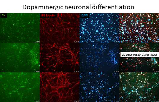 배아줄기세포 기반 도파민성 신경세포 분화 확인
