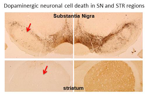 도파민성 신경세포 사멸 여부 평가