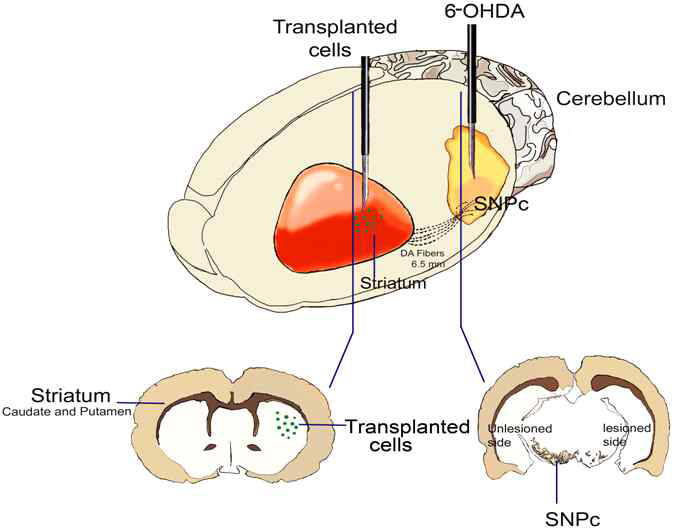 6-OHDA와 세포이식 위치