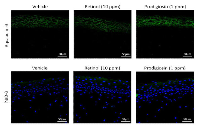 개발 소재에 의한 표피 내 Aquaporin-3 단백질과 human beta-defensin (hBD)-3 단백질 발현 분석 결과 (면역조직화학염색. 배율:400배)