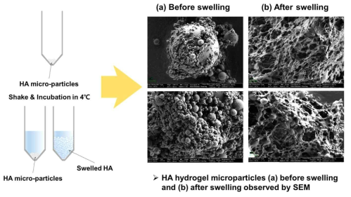 화학적으로 가교된 HA 미립구의 팽윤 전/후 SEM 이미지