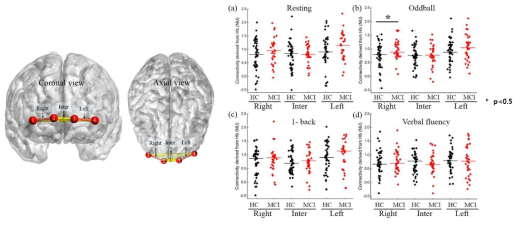 fNIRS 신호를 이용한 기능적 연결성 분석 결과 (HC(n=47), MCI(n=33); p-value *: p<0.05)