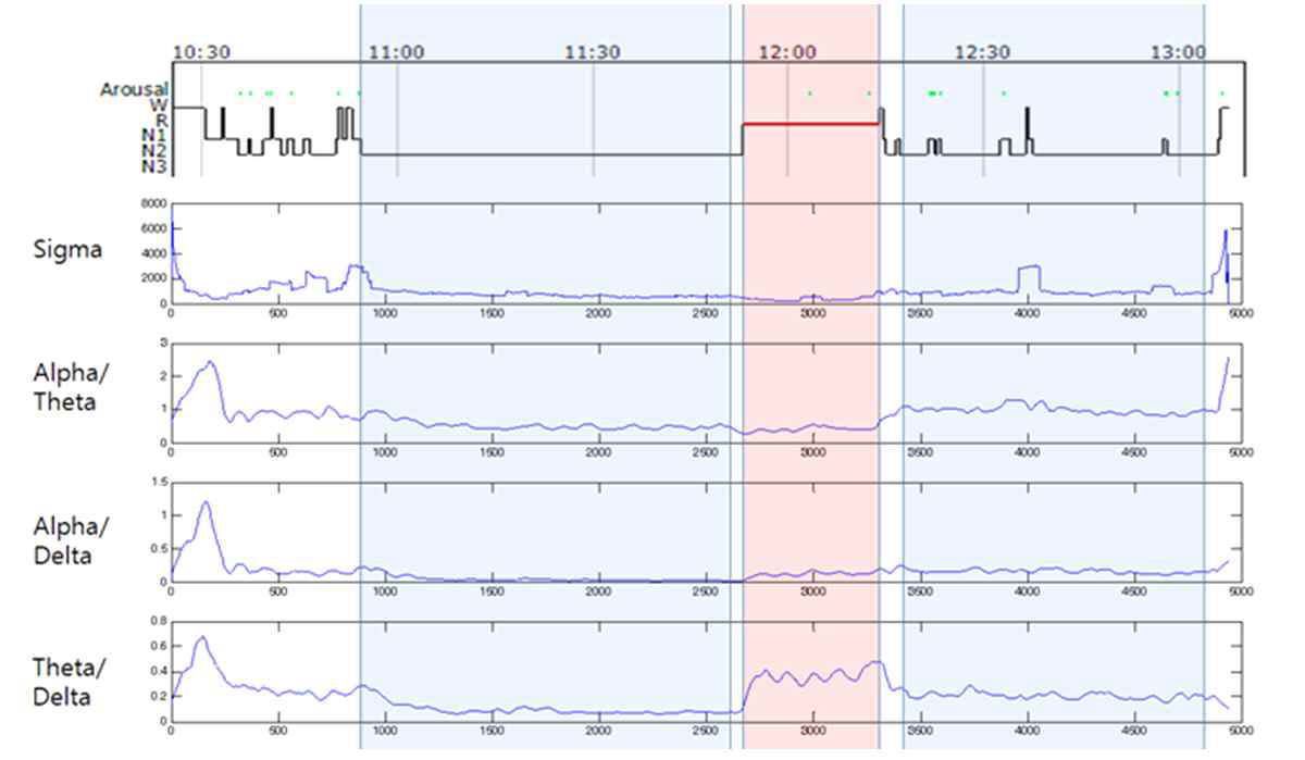 수면 단계별 뇌파 특징 blue box: 2~3단계 수면, red box: REM 수면