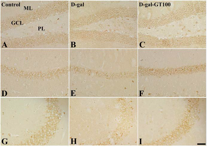 D-galactose 장기 투여에 의한 해마 CA1 및 CA3 area에서 LPA1 receptor 발현 정도를 억제하나 진토닌 경구 투여는 LPA1 receptor 발현 정도를 회복시키는 것으로 나타남. (A, D, E; dentate gyrus, D, E ,F; CA1 area, G, H, I; CA3 area)